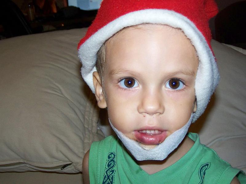 avantnoel 041
